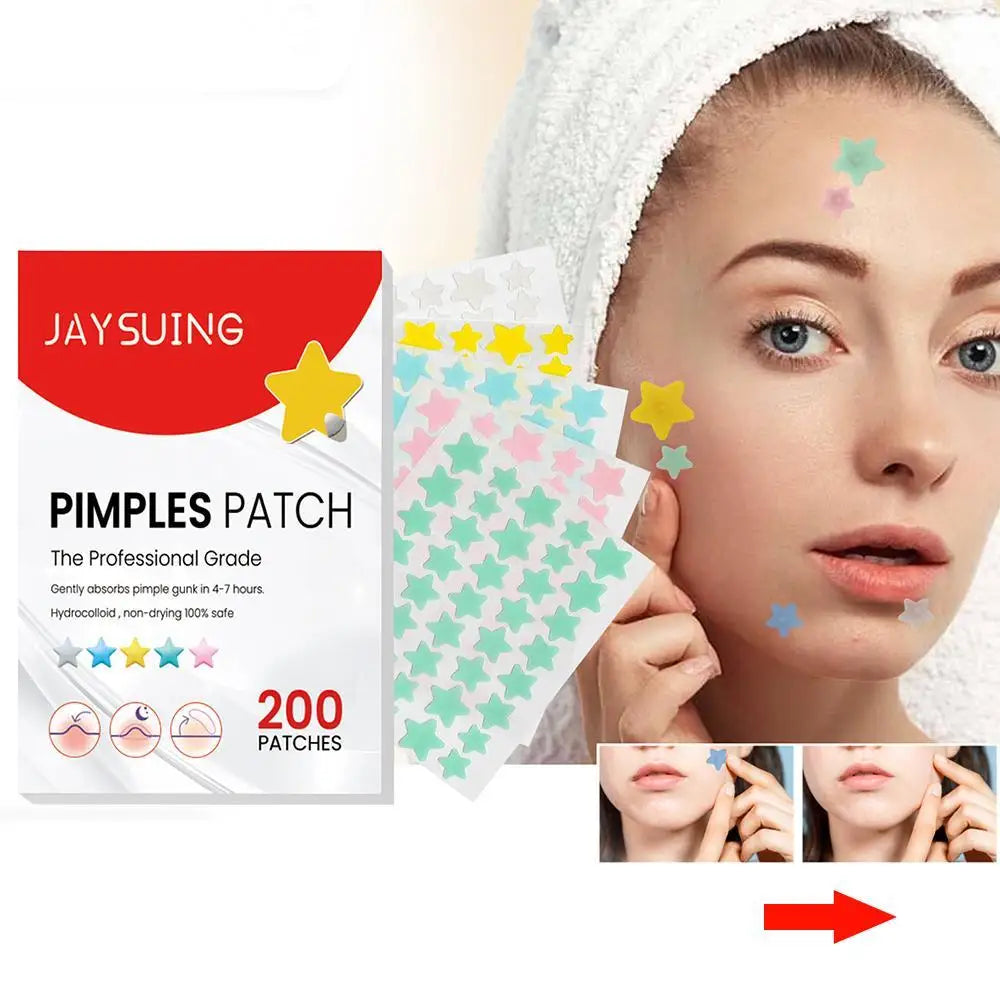 200Pcs Star Shape Pimple Patches Colorful Hydrocolloid Pimple Healing Sticker Cute Strong Absorption Zit Patches Face Care