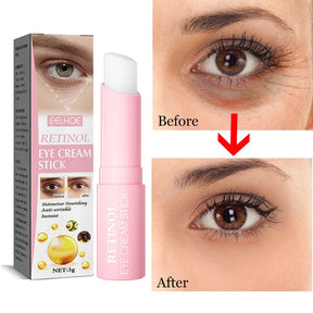 Retinol Eye Cream Instant Removing Eyes Wrinkle Eyes Dark Circles Bags Remover Moisturizing Stick Beauty Health Korea Cosmetics