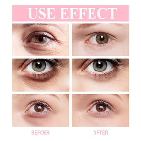 Retinol Eye Cream Instant Removing Eyes Wrinkle Eyes Dark Circles Bags Remover Moisturizing Stick Beauty Health Korea Cosmetics